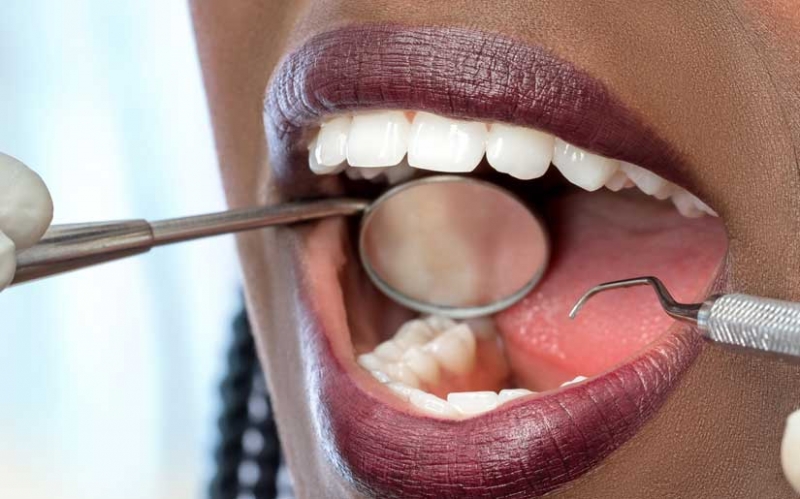 Matibabu ya Mzizi wa Jino (Root Canal Treatment)