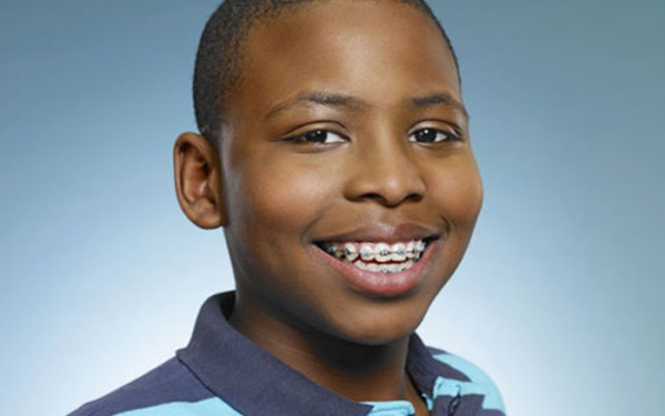 Matibabu ya Meno Yaliyojipanga Vibaya (Orthodontic treatment)