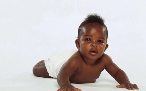 Tundu Katika Kuta za Chini za Moyo (Ventricular Septal Defect)