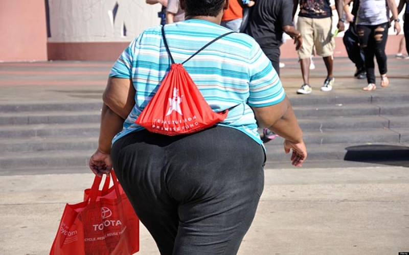 Unene Uliopitiliza (Obesity)