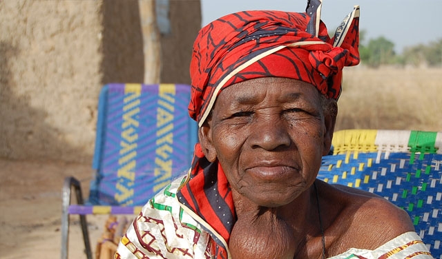 Kuvimba kwa Tezi ya Thyroid (Goiter)